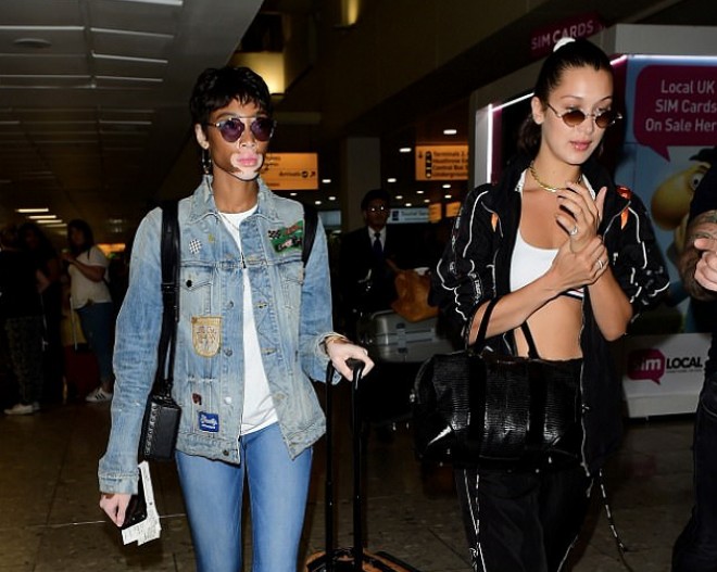 Dünyanın ən fərqli modeli və Bella Londona qayıtdı - foto