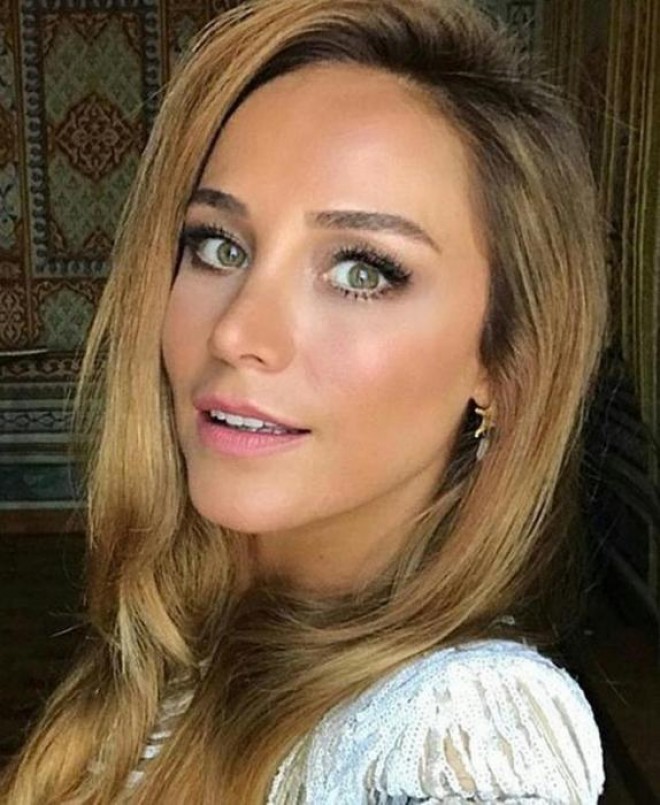 Burçin: "Botoks filan etdirməmişəm"