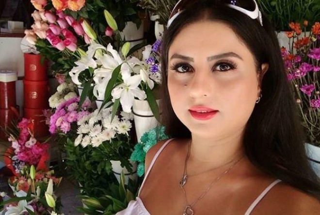 Aktrisanın əməliyyatdan sonrakı şəkli