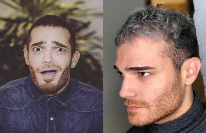 Elnur Hüseynov saçlarını ağartdı - foto