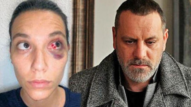 Aktyor məhkəməyə müraciət etdi