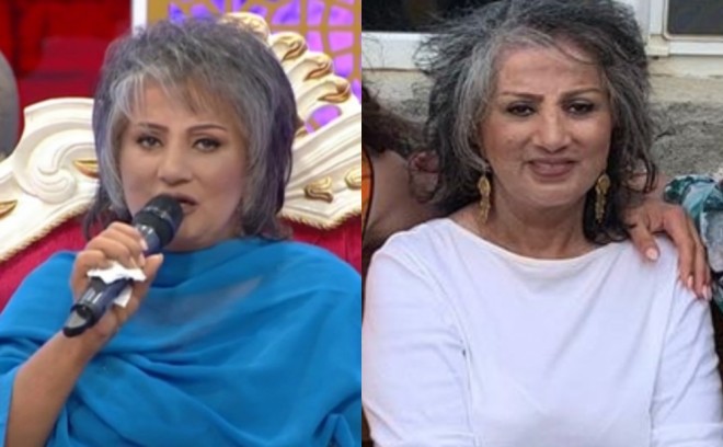 Saçları tamamilə ağardı - foto