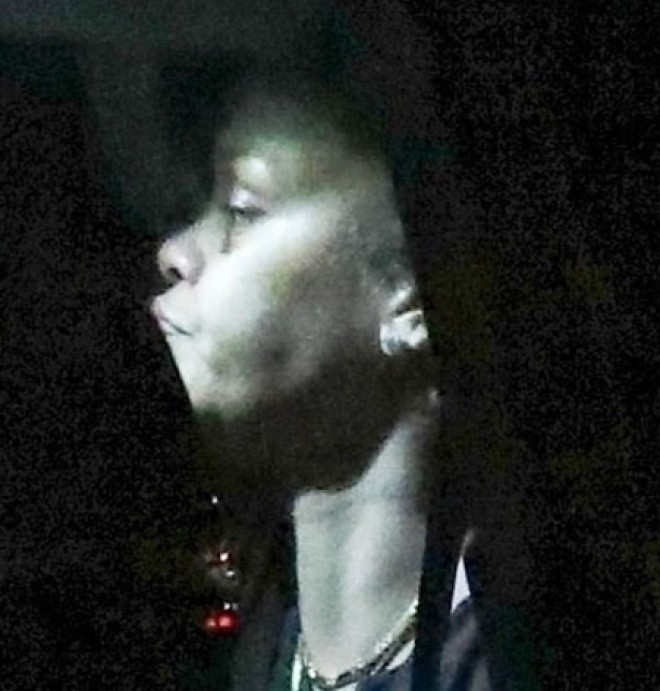 Rihannanın üzünə ləkə düşdü