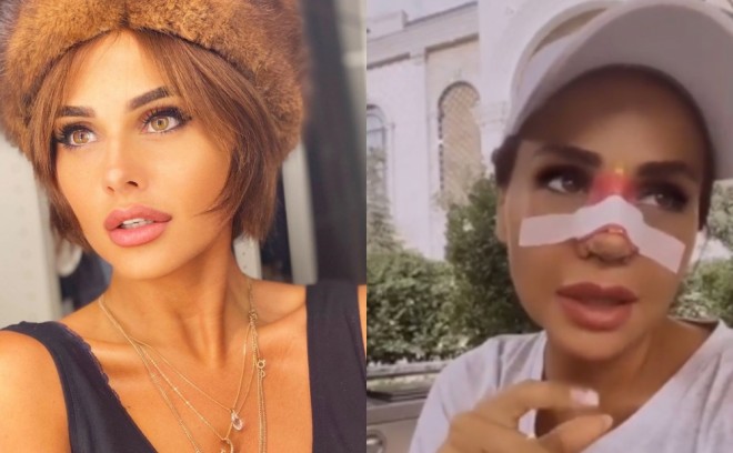 Günel yenə plastik əməliyyat etdirdi