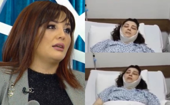 Səidə plastik əməliyyat etdirib - foto
