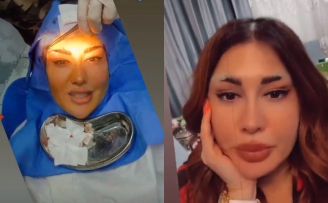 Fatimə plastik əməliyyat etdirib - foto