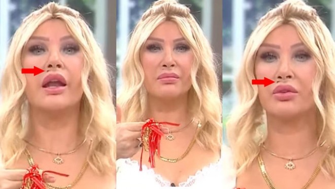 Seda Sayan dodağından danışdı - foto