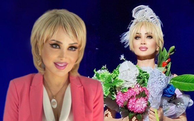 Xalq artisti görünüşünü dəyişib - foto