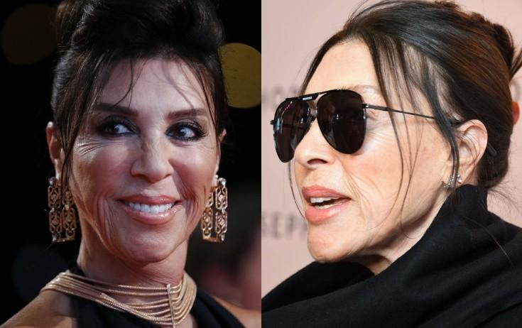 Nebahat estetik etdirməyib